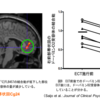 精神科身体療法の歴史