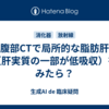 腹部CTで局所的な脂肪肝（肝実質の一部が低吸収）をみたら？