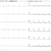 ECG-084：answer