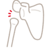 【脱臼の怖さを吹っ飛ばせ】反復性肩関節脱臼について解説