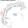 体部位局在性から考える最適なAIM方法