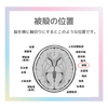 脳のお話　被殻の働き
