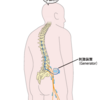 脊髄刺激療法ってなに？どんな治療方法なの？
