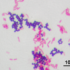 グラム染色と培養検査の違い