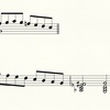 音楽療法=モーツァルト？