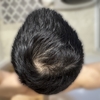 8ヵ月+5日目　8month & 5days