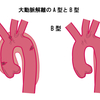 他人事ではない！5分でわかる大動脈解離