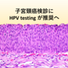 国がん、子宮頸癌のスクリーニング検査としてHPV検査を推奨へ