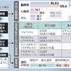 不整脈が原因の脳梗塞