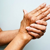 CBD Eliquids Could Be an Effective Treatment for Arthritis