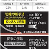 大腸ポリープ、新たな切除法