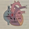 心房中隔欠損症と心室中隔欠損症