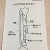 右脛骨粉砕骨折日記➄