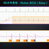 ECG-352：answer