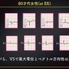 ECG-263：answer(1/2)