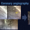 ECG-136：answer