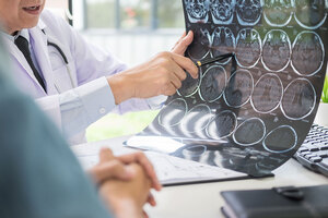 脳卒中を含む脳・心血管疾患対策にフォーネスビジュアス。4年以内の発症・再発リスクを予測