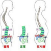 腰痛の対処法～その①～