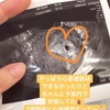 行ってきました産婦人科🤰👶🏻✨