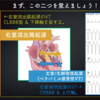 ECG-363：answer その3  VTらしい波形のいろいろ= 心電図検定試験：傾向と対策 Q.011 =
