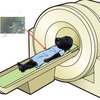 MRI検査ですべてがわかるわけじゃない