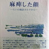 麻痺した顔　らいの検診カルテから　原田禹雄