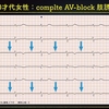 ECG-207：answer