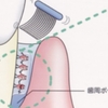 口臭は病気です。