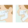 小顔に関わる顎関節
