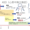 心房中隔欠損症(ASD：Atrial Septal Defect)について　〜　疾患4