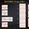 ECG-319：answer