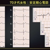 ECG-238：answer