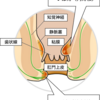 〜ジオン〜新しい内痔核の治療法