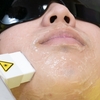 ヒゲ脱毛で清潔感アップ！美意識向上！見た目だけじゃないメリットとは？