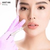 Tiêm filler là gì? Địa chỉ tiêm filler uy tín ở Hà Nội