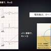 ECG-162：answer