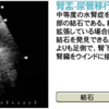 尿路結石での超音波検査の意義と見え方
