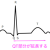 QT延長の定義とその原因