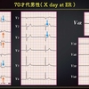 ECG-283：answer