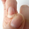 Des ongles cassants ou dédoublés : 3 recettes pour lutter contre le dédoublement des ongles