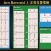 ECG-218：answer