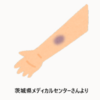 愛すべき信州の方言：「ちーしんだ」と「ちだらまっか」