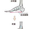 足部のアーチ機能とは?外側縦アーチに着目！