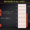 ECG-290：answer