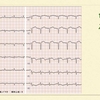 ECG-195:answer(1/2)