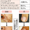 がん新薬で皮膚障害