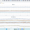 【 兵庫 ０．１０７ μ 】