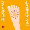 右足甲に少しかゆいコイン状の湿疹