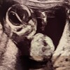 14w つわりの終わり＆妊婦健診