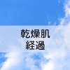 0歳次男、やっぱり乾燥肌